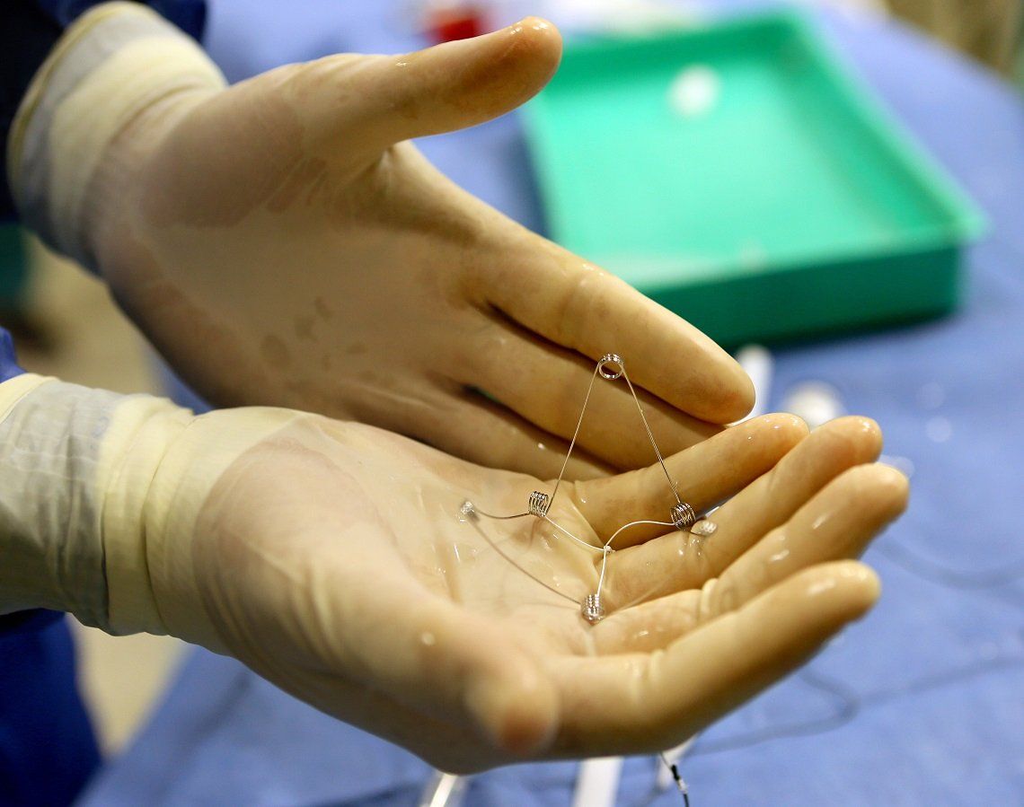 CORolla, implante israelí para tratar la insuficiencia cardíaca probado por primera vez