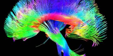 Elimina los temblores de Parkinson sin dolor