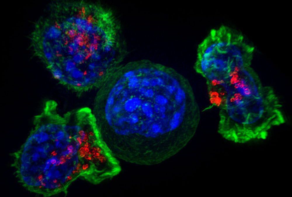 Las células asesinas T podrían destruir tumores cancerosos