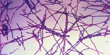 Informe: Corea del Norte prueba ojivas biológicas para sus misiles