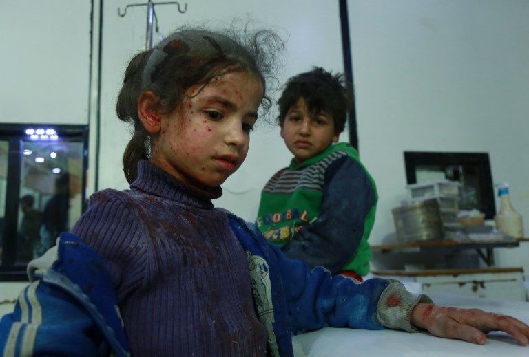 Dos niños sirios heridos esperan ayuda médica en un hospital improvisado tras los ataques aéreos de las fuerzas del régimen en la ciudad de Douma, en la sitiada región oriental de Ghouta, en las afueras de la capital, Damasco, el 23 de febrero de 2018. (AFP PHOTO / HAMZA AL-AJWEH)