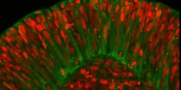 Captura de pantalla de imágenes aceleradas que muestra el desarrollo de un organoide cerebral que incorpora la mutación genética que causa el síndrome del cerebro liso. (Captura de pantalla de Youtube)