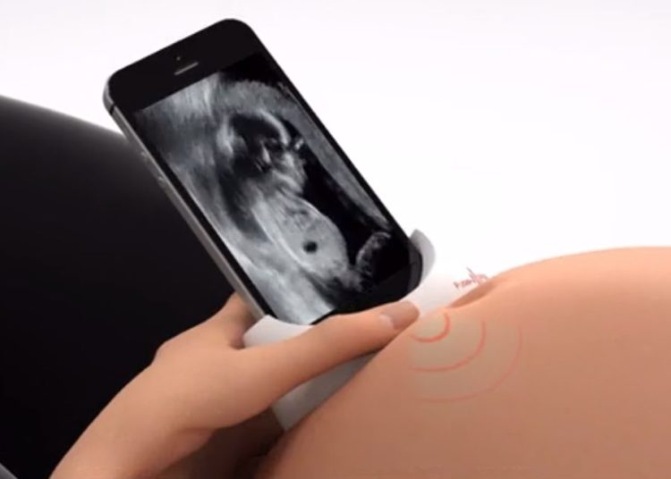 Dispositivo israelí permitirá a mujeres embarazadas tomar ecografías con el smartphone