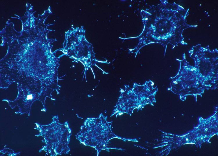 Israeli researchers say they have found a way to curb growth of cancer cells