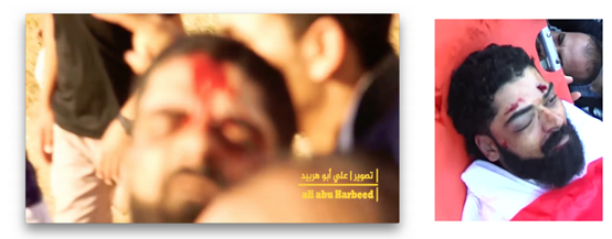 Dos versiones diferentes de la lesión cerebral letal de Abu Thuraya, como se ve en los videos de propaganda palestinos. Foto: capturas de pantalla.