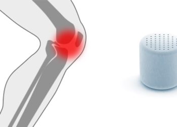 Innovador implante de rodilla inventado en Israel utilizado por primera vez - Agili-C