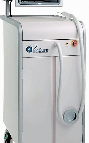 Dispositivo ProSense de IceCure Medical (Cortesía)