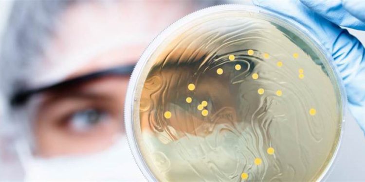 Científicos israelíes encuentran que los probióticos son suplementos “inútiles” para la salud