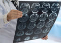 Software israelí de lectura de escáner cerebral recibe aprobación de la FDA