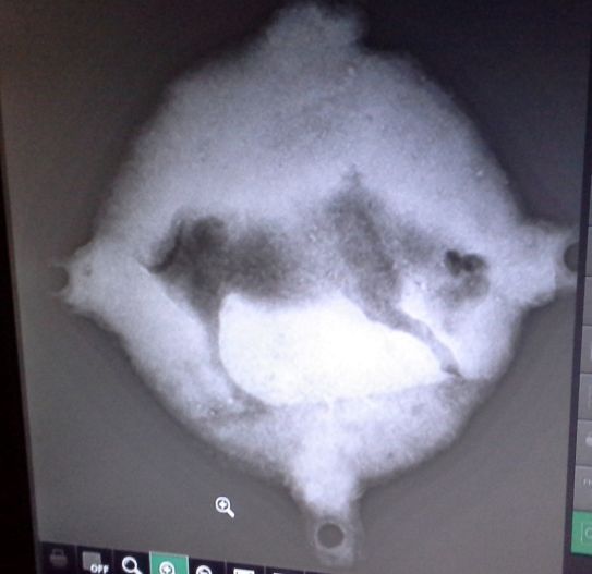 Radiografía de lo que parece ser una pieza faltante del mecanismo de Anticitera, que muestra a Tauro el toro EUA