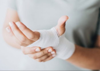 Innovador dispositivo médico israelí trata las quemaduras sin tocar al paciente