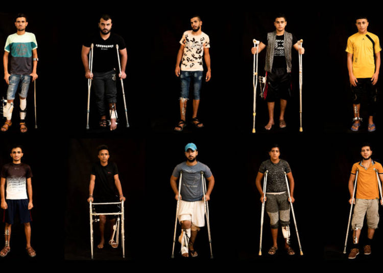 En esta combinación de 10 fotos tomadas el 19 de septiembre de 2018, los palestinos que recibieron disparos en las piernas durante manifestaciones y disturbios en la frontera de la Franja de Gaza con Israel esperan tratamiento en una clínica de la Ciudad de Gaza dirigida por MSF (Doctors Without Borders). (Foto AP / Felipe Dana)