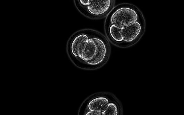 Investigadores de la Universidad Hebrea Hebrea de Jerusalén dicen que han encontrado una manera de transformar las células de la piel en los tres tipos principales de células madre que comprenden embriones en etapa temprana; La imagen muestra embriones de ratón de 4 células (Kirill Makedonski).