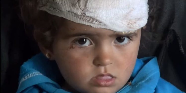 Putin y Assad mataron a su familia, pero Khadija, de dos años, sobrevivió