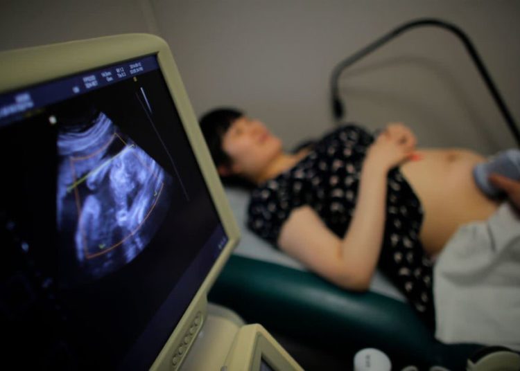 Wu Tianyang, que está embarazada de cinco meses de su segundo hijo, asiste a una ecografía en un hospital local en Shanghai el 12 de septiembre de 2014.. (Crédito de la foto: CARLOS BARRIA / REUTERS)