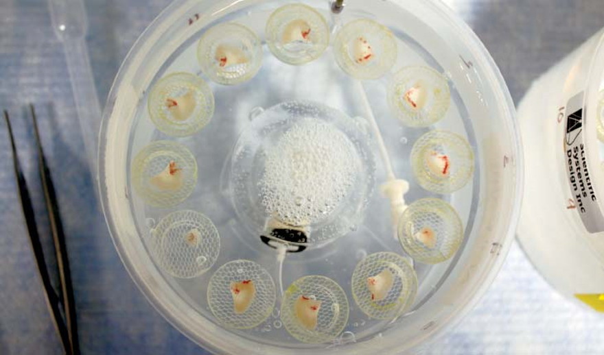 Cómo piezas de cerebro humano vivo están ayudando a los científicos a mapear las células nerviosas