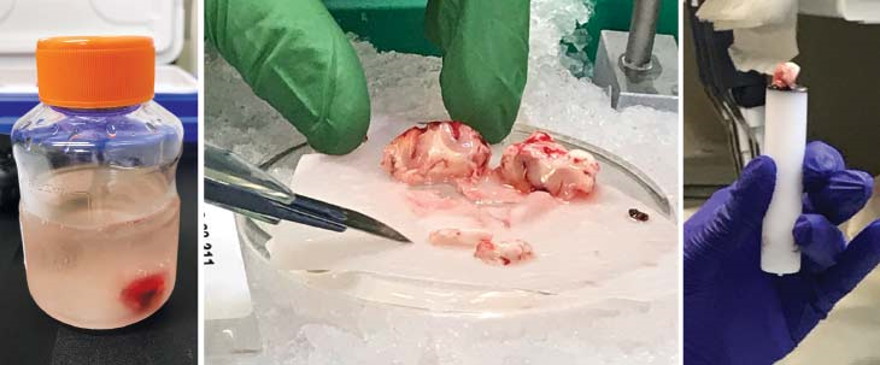 Cómo piezas de cerebro humano vivo están ayudando a los científicos a mapear las células nerviosas