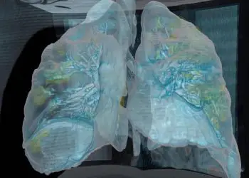 Video revela daño pulmonar en paciente de coronavirus: “Las personas deben tomar esto en serio”