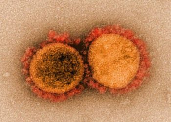 Sangre de personas que se recuperan del Coronavirus podría proporcionar un tratamiento
