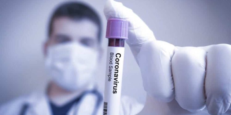 Seis respuestas judías al Coronavirus