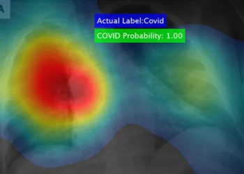 Poderoso software puede detectar el coronavirus en segundos con una precisión del 98%.