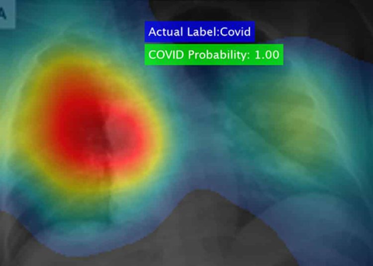 Poderoso software puede detectar el coronavirus en segundos con una precisión del 98%.