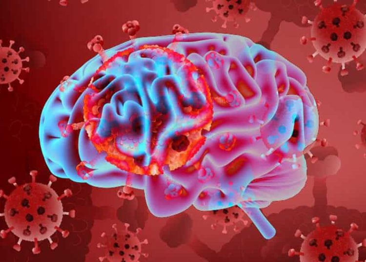 COVID-19 puede dañar funciones del cerebro