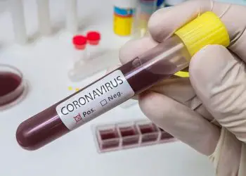 Coronavirus en Israel: 14.592 casos, 136 en estado crítico y 191 muertos