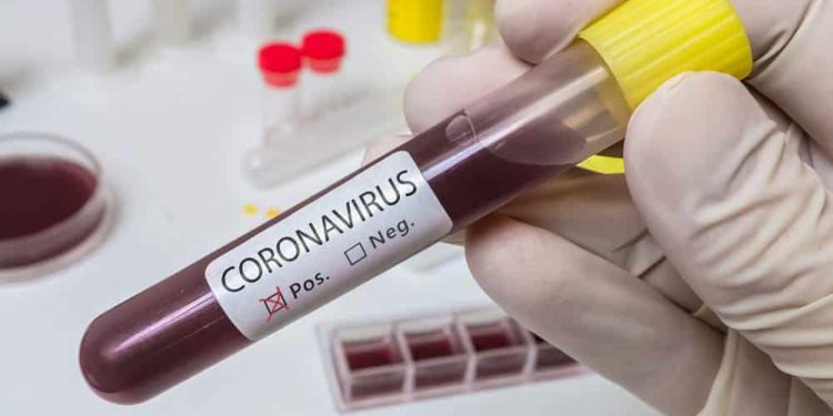 Coronavirus en Israel: 14.592 casos, 136 en estado crítico y 191 muertos