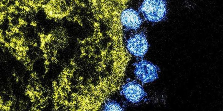 Científicos de Israel crean filtro de aire capaz de capturar y destruir cepas de coronavirus