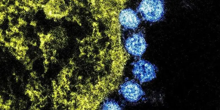 Científicos de Israel crean filtro de aire capaz de capturar y destruir cepas de coronavirus