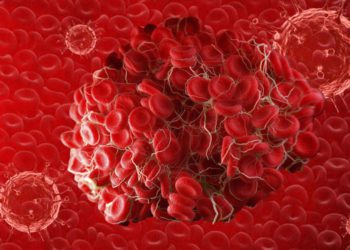 El coronavirus causa coágulos sanguíneos dañinos desde el cerebro hasta los dedos de los pies