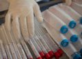 Israel iniciará pruebas serológicas de coronavirus esta semana