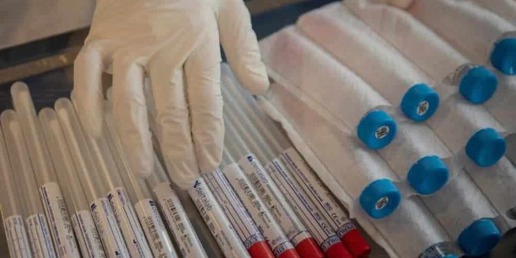 Israel iniciará pruebas serológicas de coronavirus esta semana