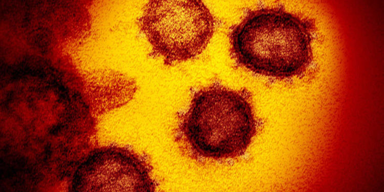 Mutación D614G aparentemente diez veces más infecciosa del Coronavirus: “Urgente preocupación”