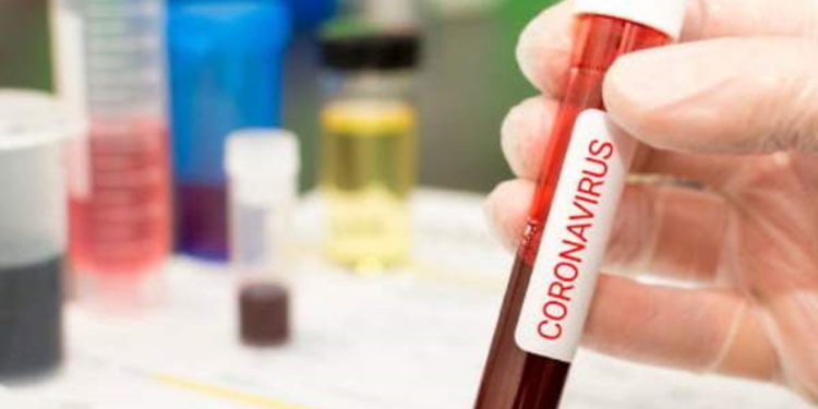 Análisis de sangre después de diagnóstico de COVID-19 predeciría la gravedad del virus