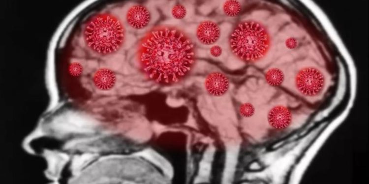 El coronavirus puede engañar a los anticuerpos para que ataquen el cerebro
