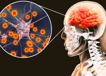 Pacientes de COVID-19 recuperados muestran graves desórdenes cerebrales