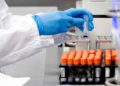 Científicos israelíes desarrollan prueba serológica “eficiente y precisa” para detectar el coronavirus