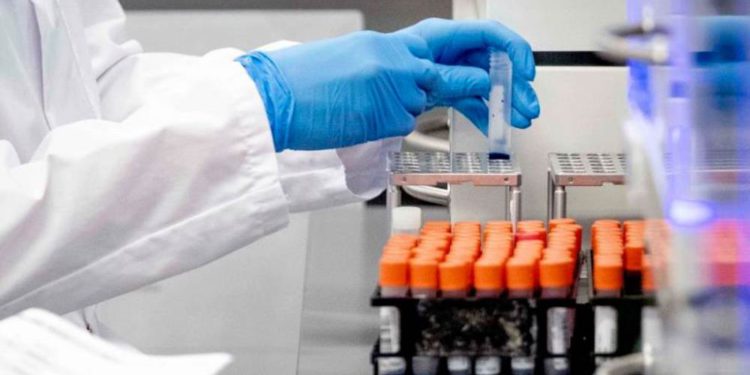 Científicos israelíes desarrollan prueba serológica “eficiente y precisa” para detectar el coronavirus