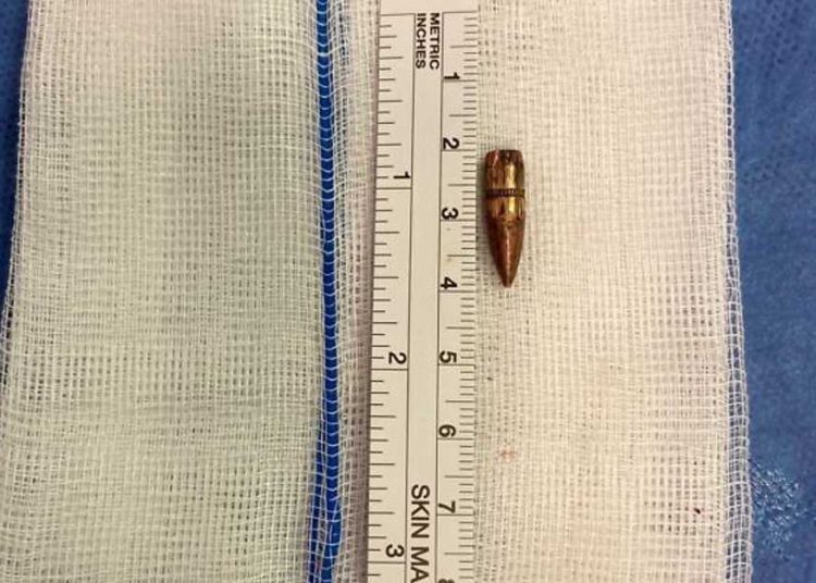 Médicos israelíes encuentran bala alojada en el cerebro de un niño de 9 años