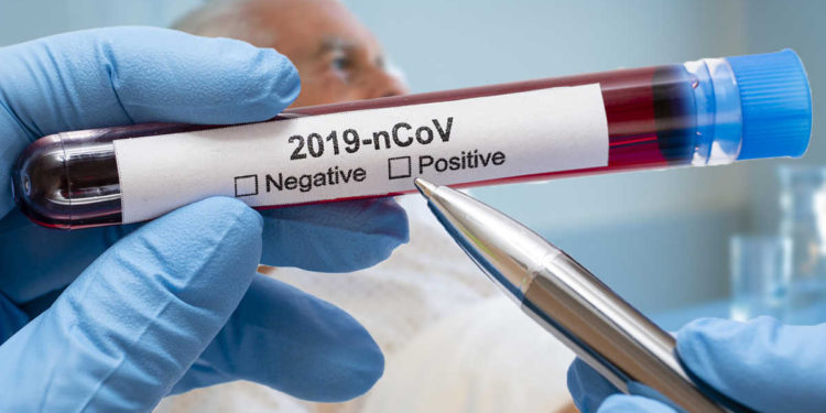 El coronavirus es más mortal si eres mayor y hombre