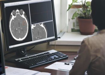 Amígdala del cerebro creció tras el cierre por coronavirus, según científicos israelíes