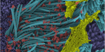 Investigadores de EE.UU. producen imágenes sorprendentes de células infectadas por coronavirus