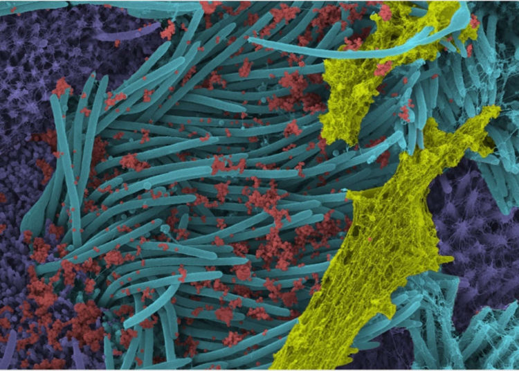 Investigadores de EE.UU. producen imágenes sorprendentes de células infectadas por coronavirus