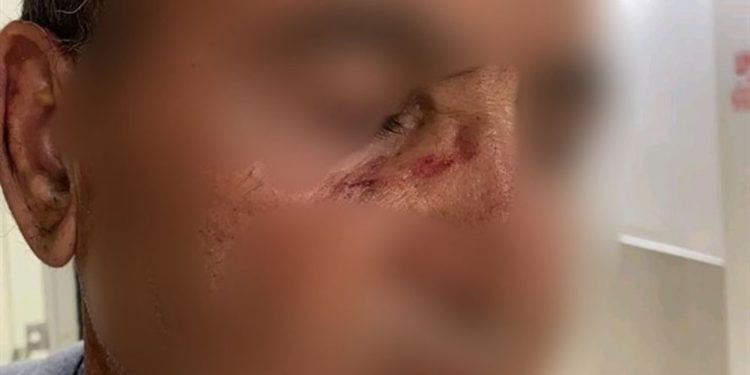 Los árabes atacan a un anciano judío y a su hijo en Jaffa