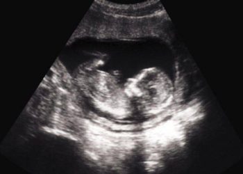 Gobierno federal sorprendido comprando órganos de bebés abortados