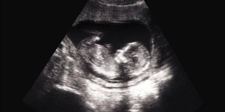 Gobierno federal sorprendido comprando órganos de bebés abortados