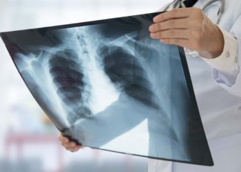 Technion de Israel desarrolla método rápido y no invasivo para diagnosticar la tuberculosis