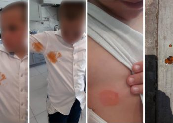 Atacan con bolas de pintura a dos niños judíos en Los Angeles